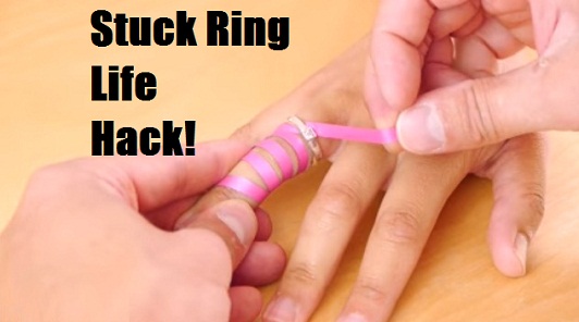 Easy Way To Remove a Ring Stuck on Finger